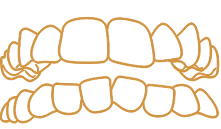 前歯が重なってデコボコになっている