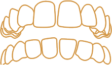 前歯に隙間がある