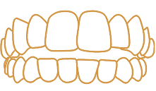 前歯だけ咬み合うことができる