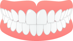 マウスピース矯正