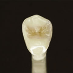 e-maxセラミック