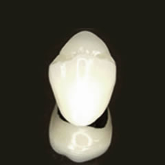 メタルボンドセラミック